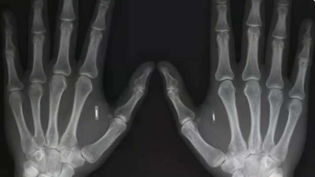 ¿Microchips implantados en el cuerpo de los empleados? En Wisconsin ya lo hacen 1