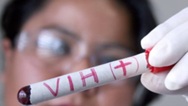 Gran avance médico: Investigadores españoles consiguen eliminar el VIH en personas con trasplantes de células madre. 4