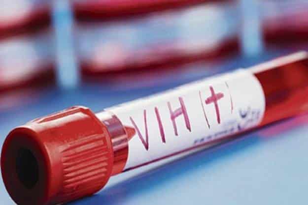 Johnson & Johnson probará una vacuna contra el VIH en EE UU y Europa 4